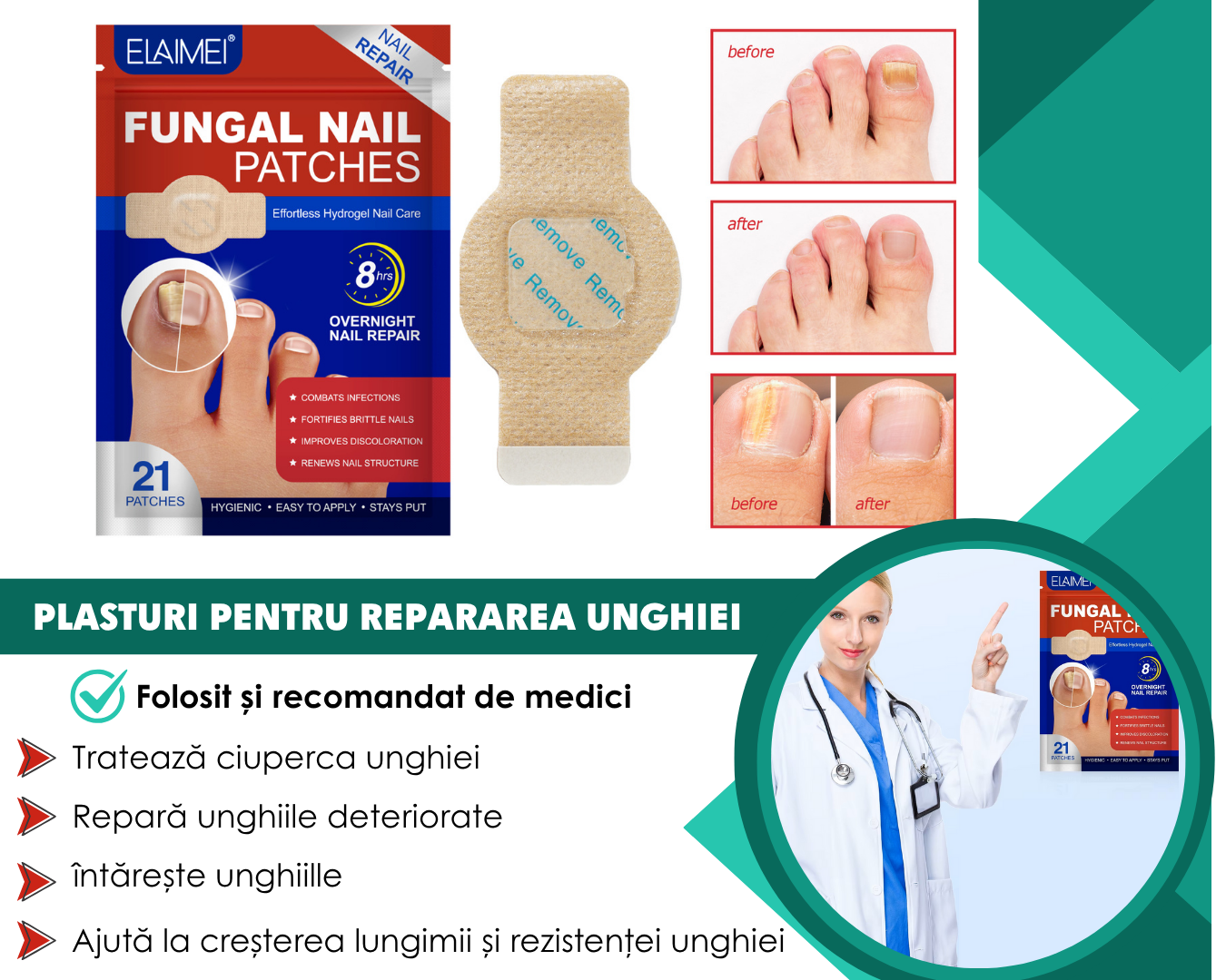 Plasturi pentru ciuperca unghiei